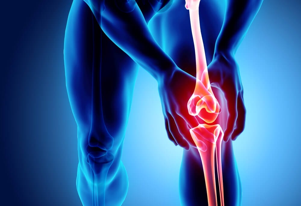Osteoarthritis