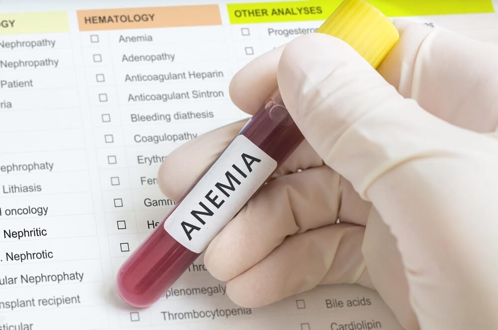Anaemia