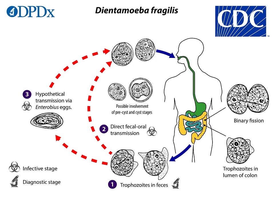 Dientamoeba fragilis