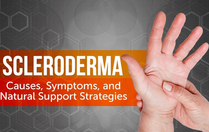 Scleroderma – A Functional Medicine Approach